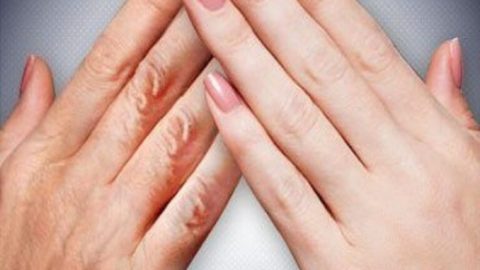 افضل 4 طرق علاج تجاعيد مفاصل اليدين بالرياض